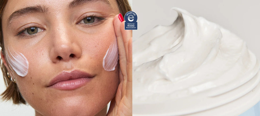 What's the Difference Between Eczema and Psoriasis?