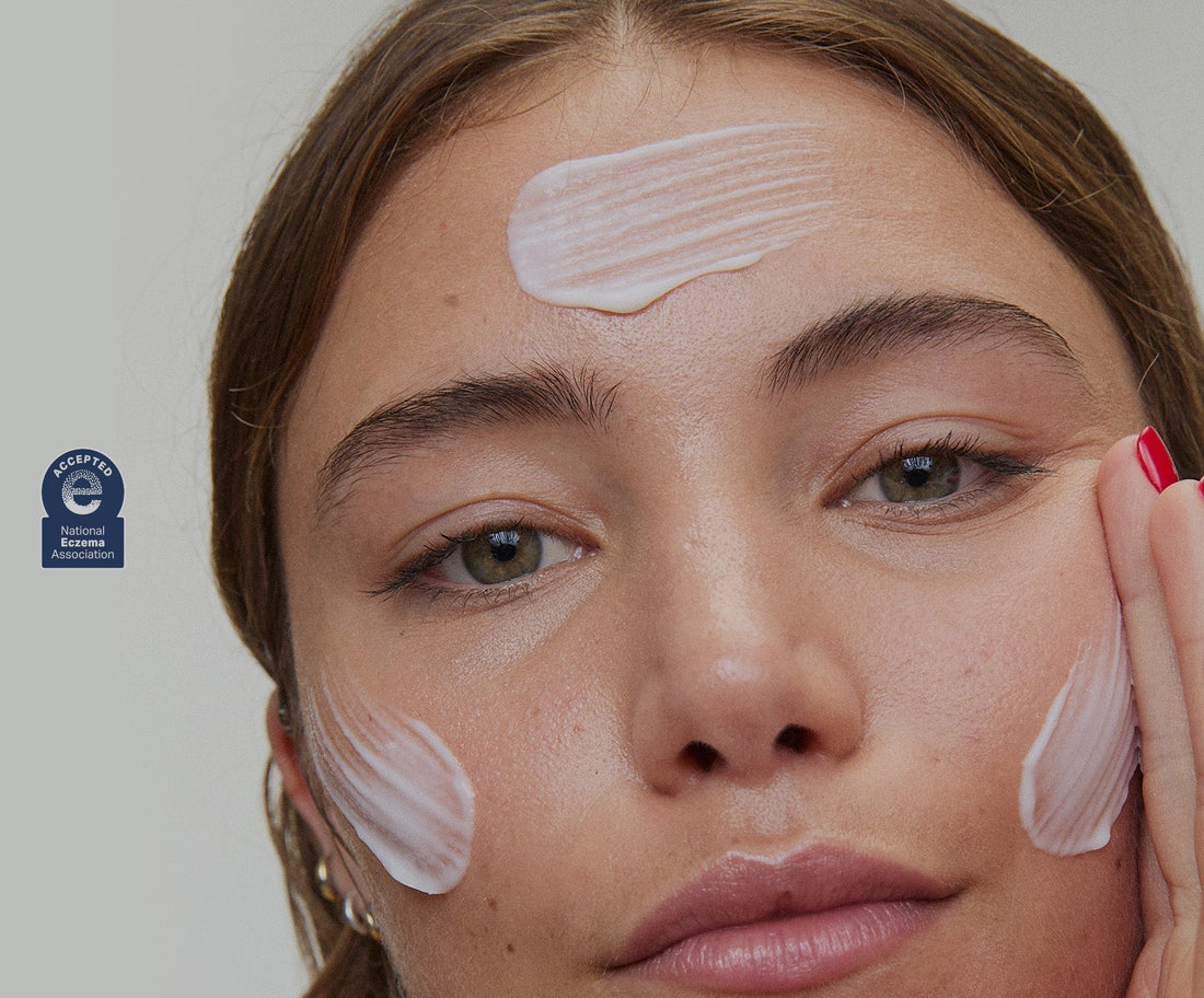 What is Eczema and How to Treat It