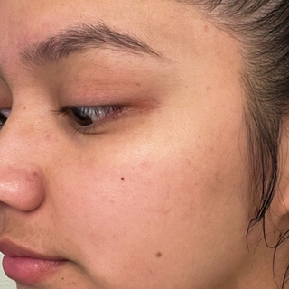 How Can You Improve Skin Texture?