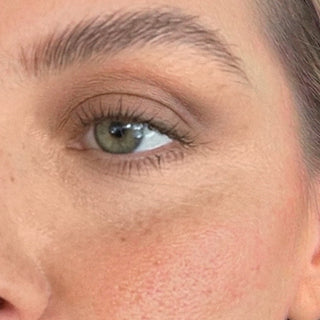 The Ultimate Guide to Targeting Puffiness and Dark Circles