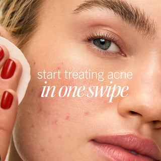 Ultimate Acne Solutions Routine