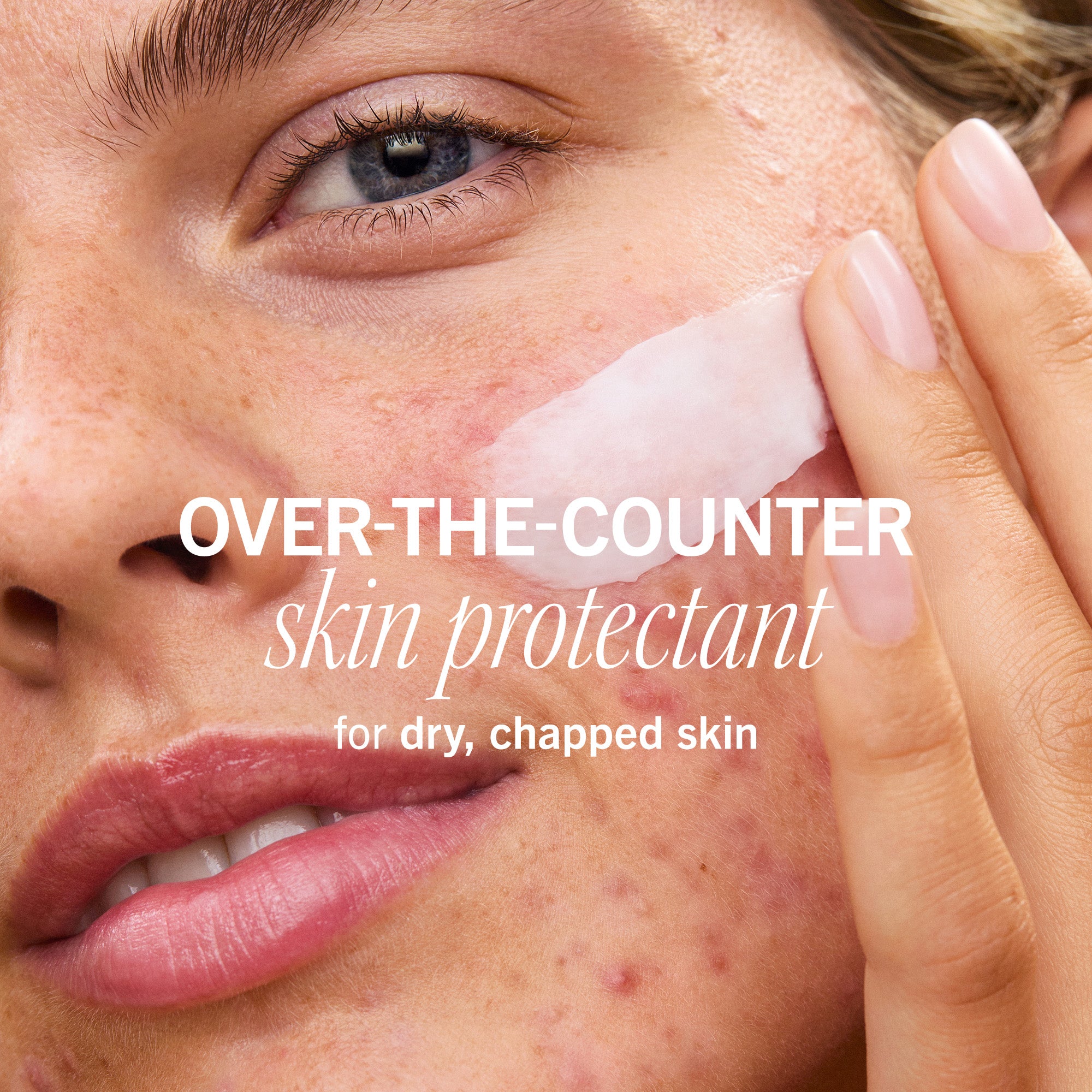 Ultra Repair Rescue Barrier Balm with Dimethicone 3