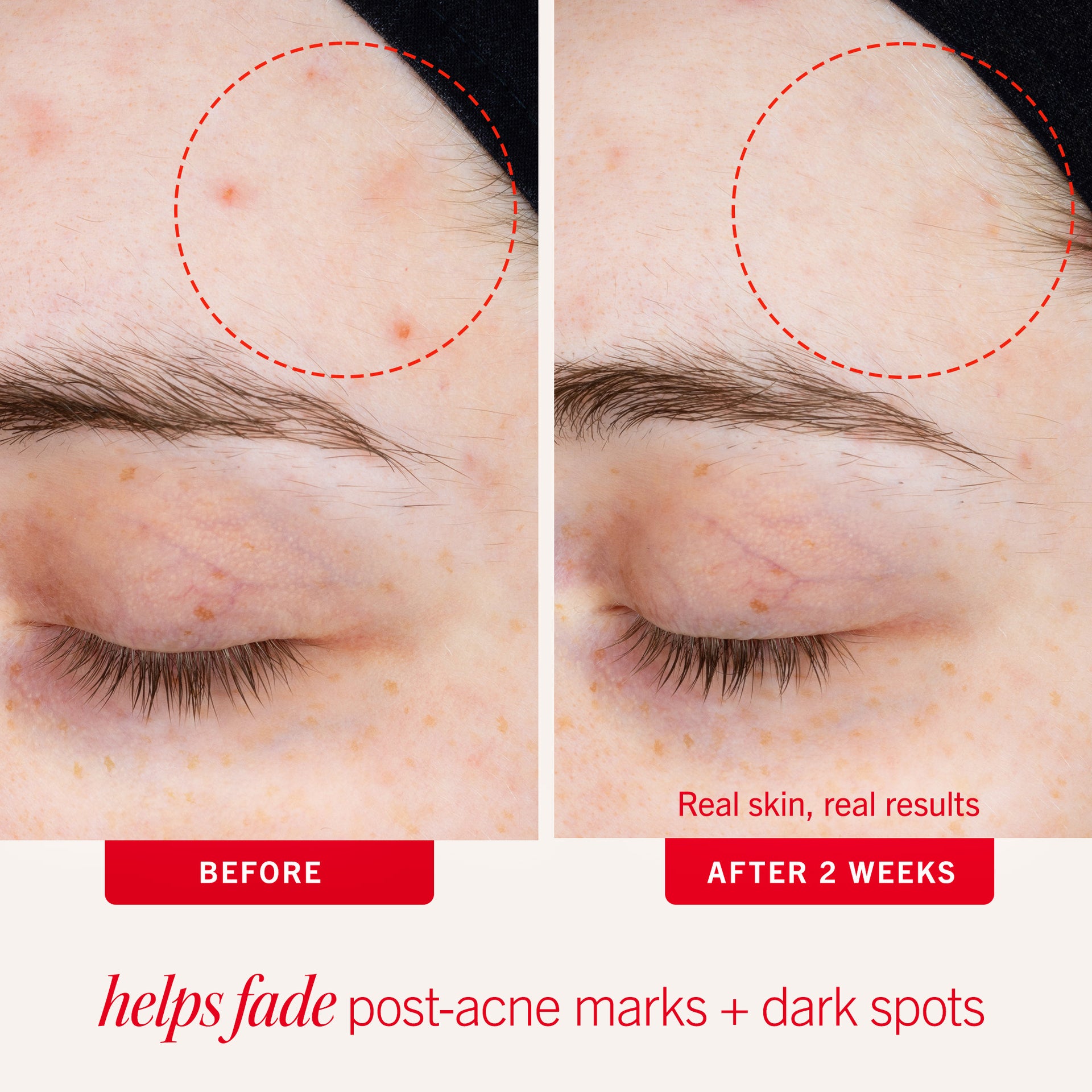 <h3 style='font-size:24px; line-height:38px; text-align:center; margin-top:0;'>Visible Results</h3>