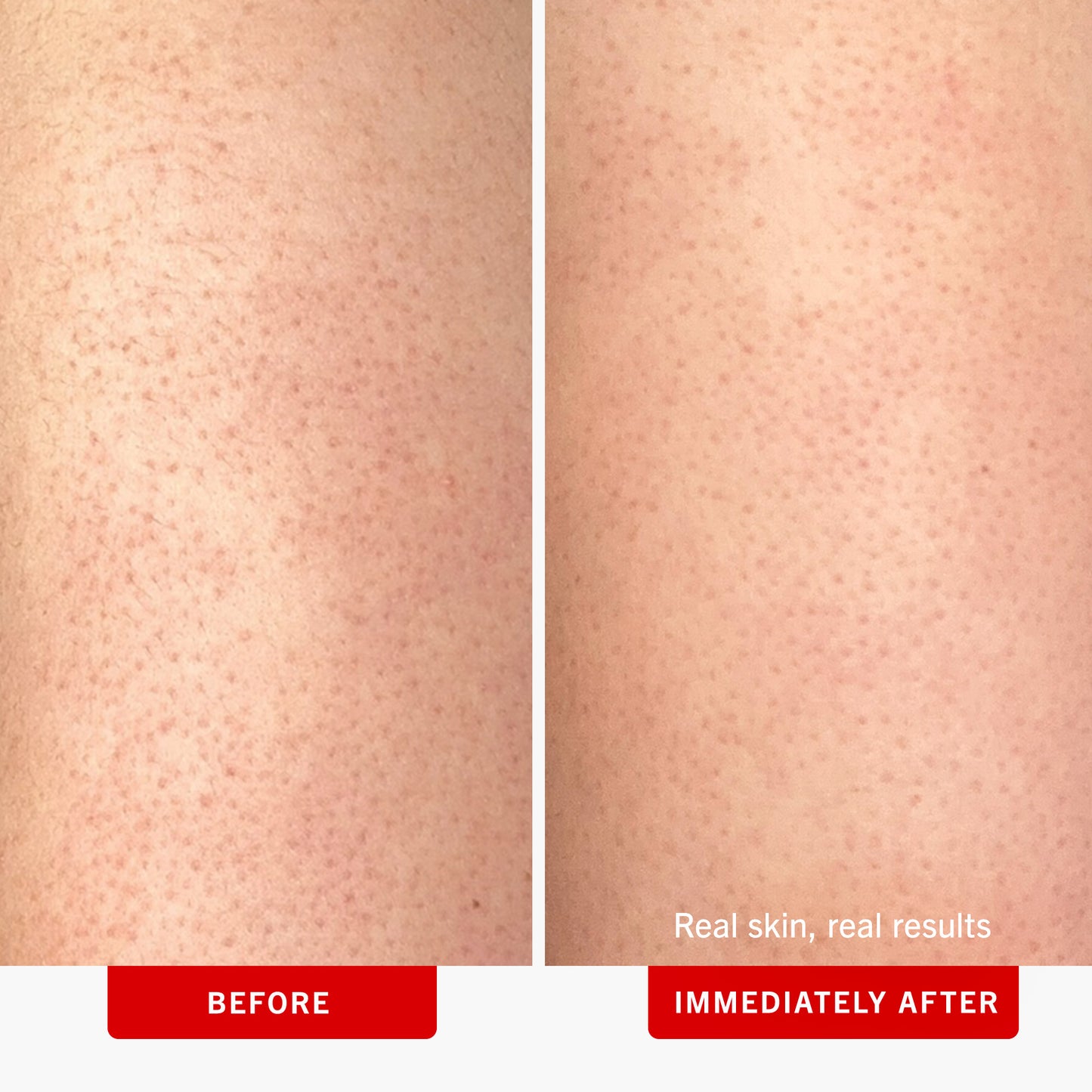 Close-up of skin with visible pores is shown in two side-by-side images: left labeled "BEFORE," right labeled "IMMEDIATELY AFTER," with text "Real skin, real results" on the right side.