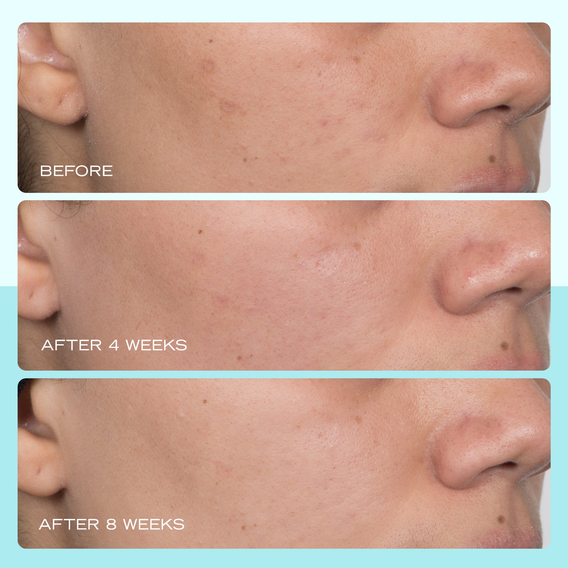 Dark Spot Serum with Niacinamide – First Aid Beauty