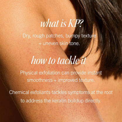 A close-up of a person's arm with text overlay. It reads: "what is KP? Dry, rough patches, bumpy texture + uneven skin tone. how to tackle it Physical exfoliation can provide instant smoothness + improved texture. Chemical exfoliants tackle symptoms at the root to address the keratin buildup directly."