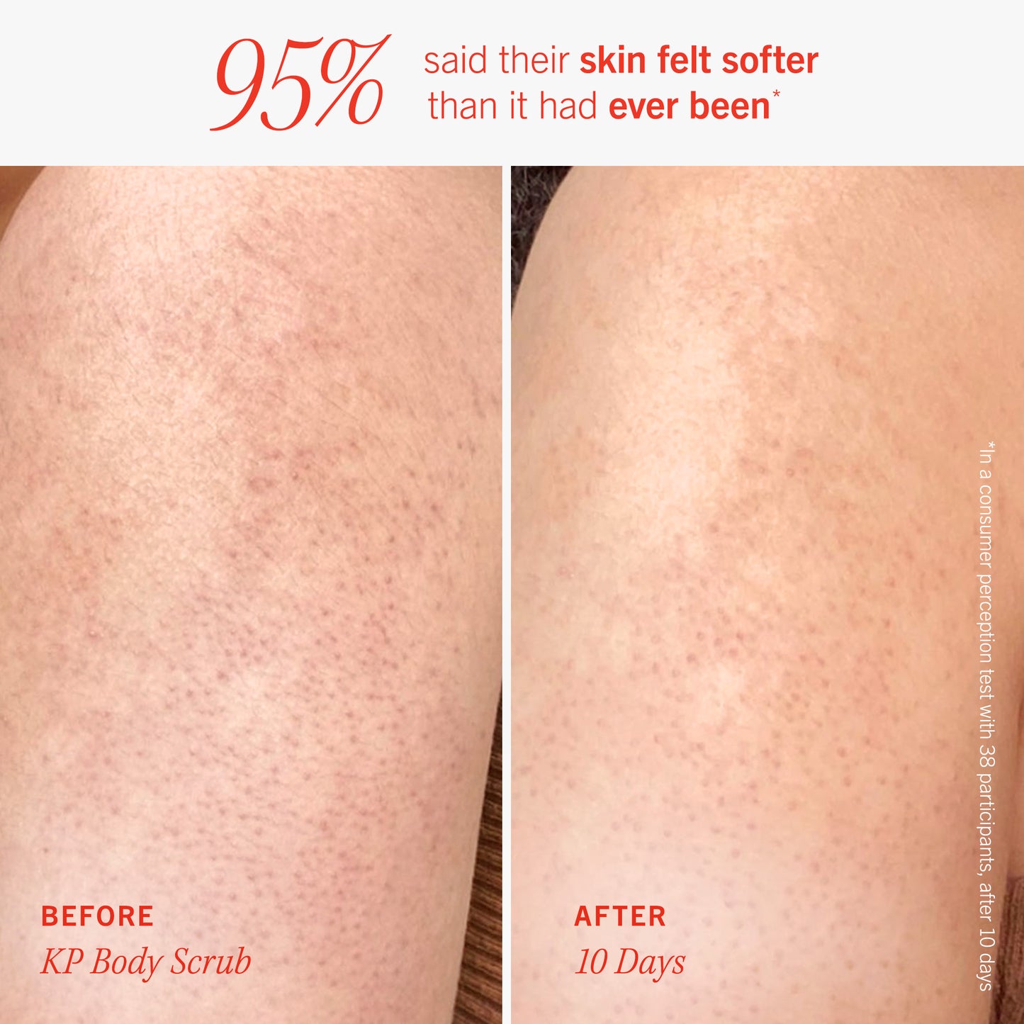 Soft + Smooth Starter Kit