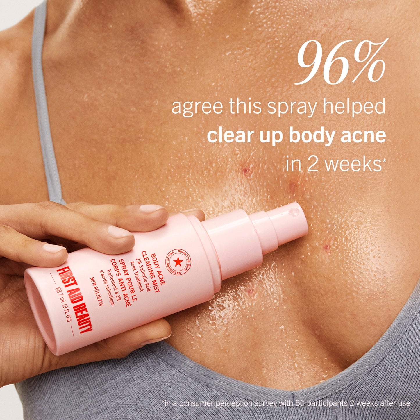Body Acne Clearing Mist 2% Salicylic Acid