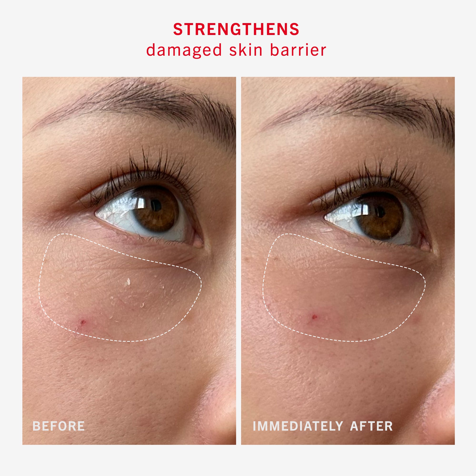 Ultra Repair Rescue Barrier Balm with Dimethicone 7
