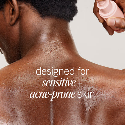 A person with damp skin has a pink spray bottle applied to their back. The text reads: “designed for sensitive + acne-prone skin.” The background is plain, emphasizing the action.