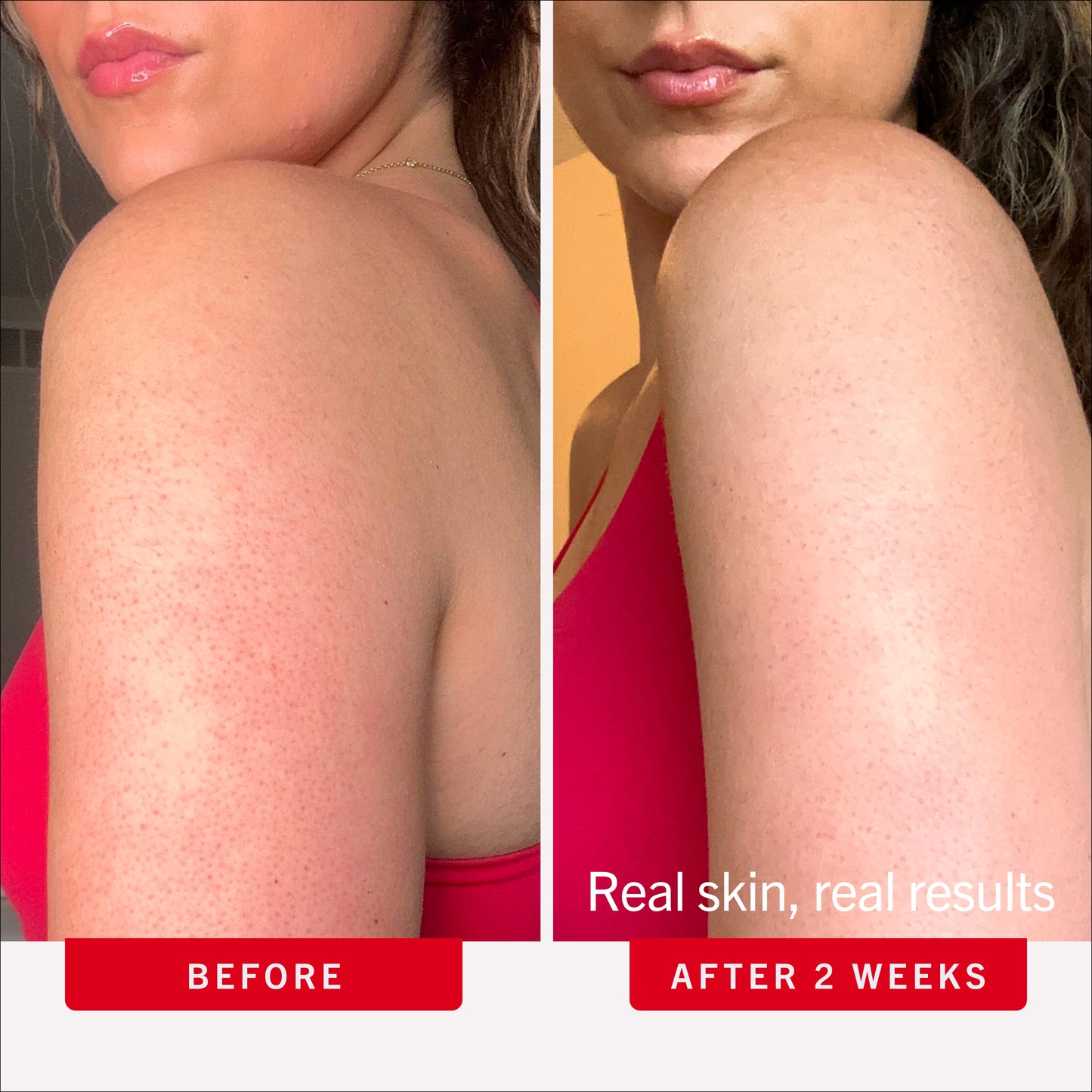 KP Bump Eraser Body Scrub 10% AHA Fresh Strawberry Travel Size