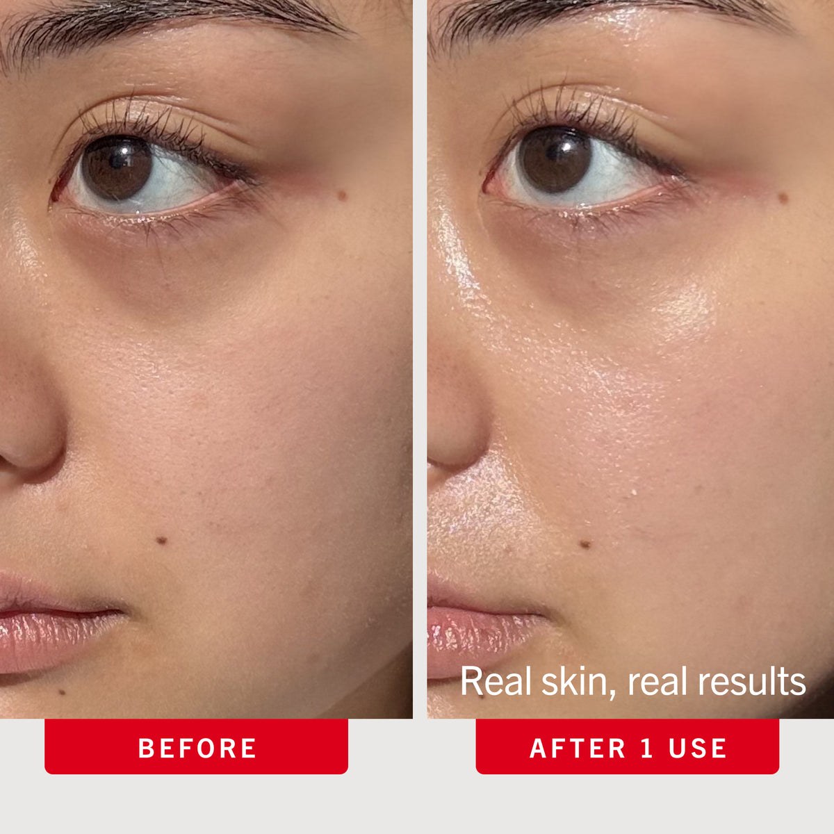 Real Skin, Real Results