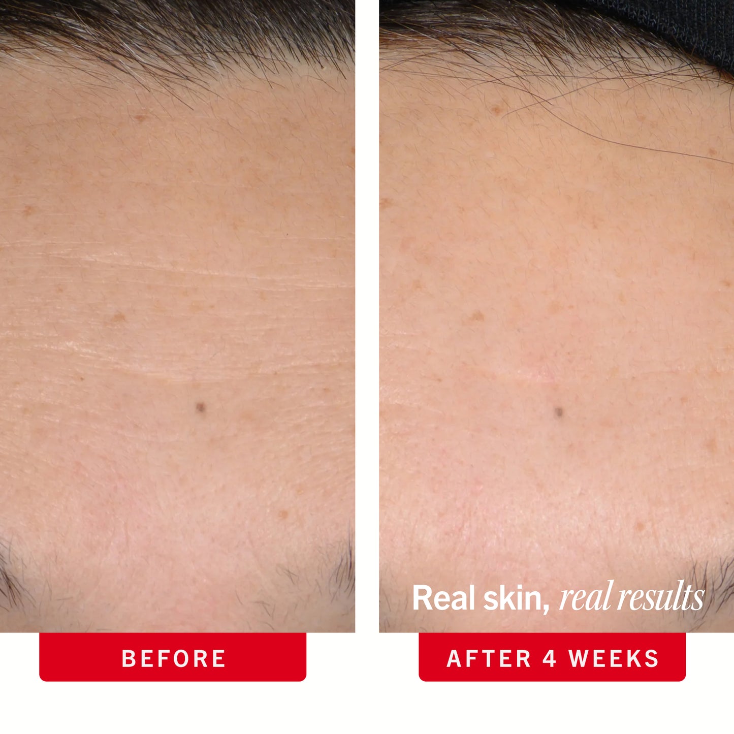 Ultra Repair Retinol Serum with 0.3% Retinol Complex + Peptides