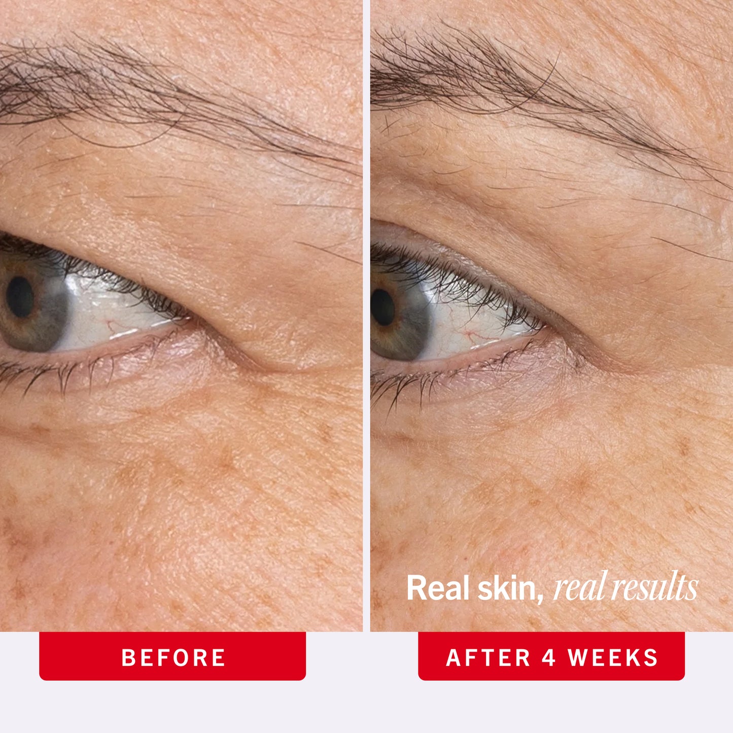 Ultra Repair Retinol Eye Cream with Retinol, Squalane + Ceramides