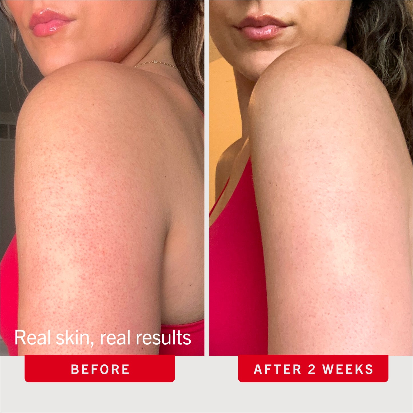 KP Bump Eraser Body Scrub 10% AHA Toasted Coconut