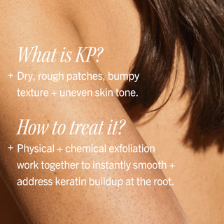 KP Bump Eraser Body Scrub 10% AHA Toasted Coconut