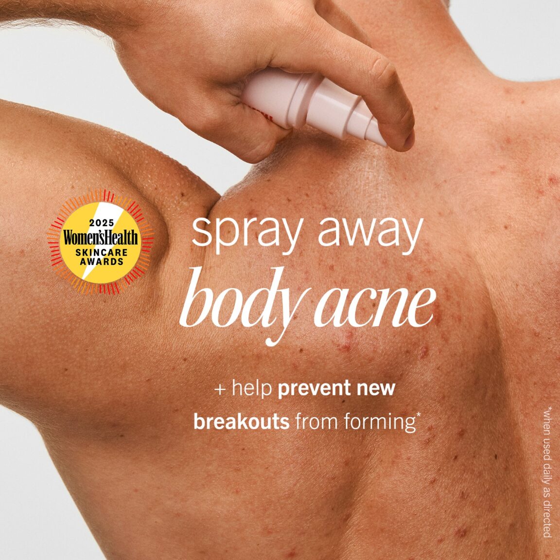 Body Acne Clearing Mist 2% Salicylic Acid