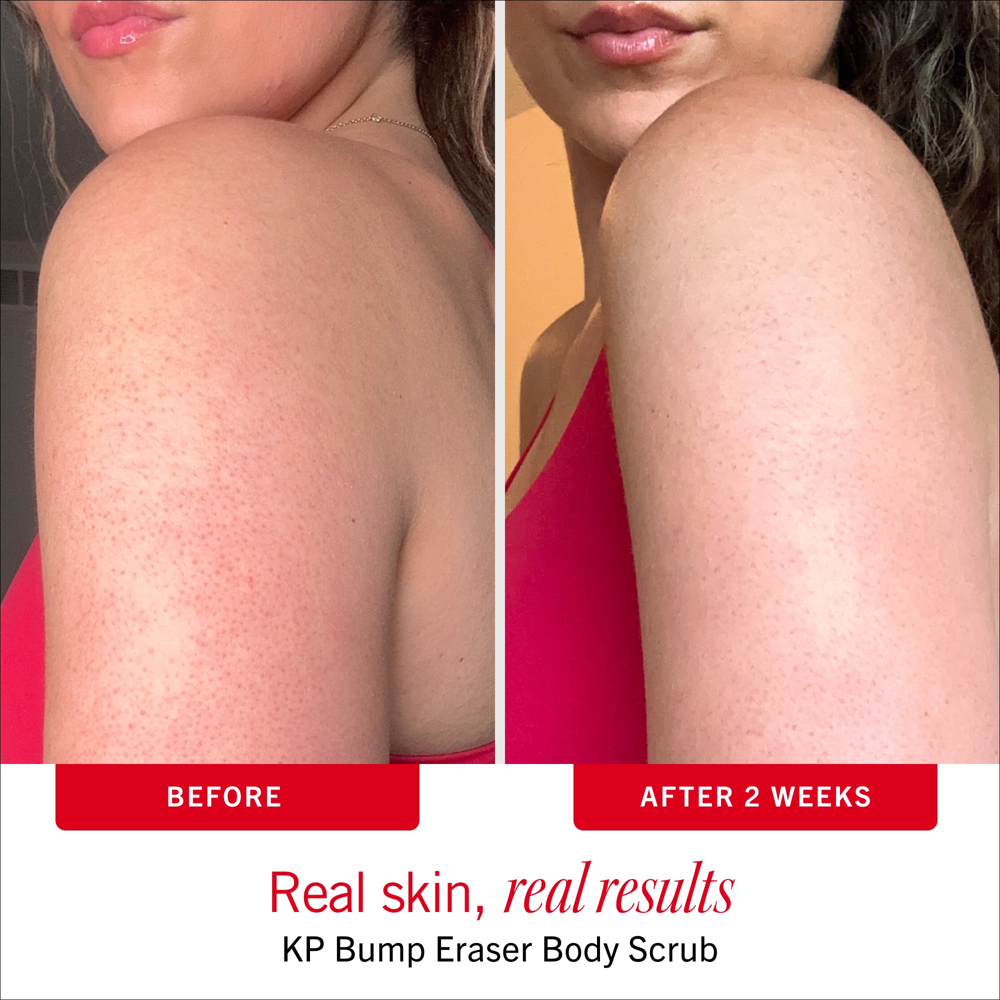 Coconut Duo – First Aid Beauty